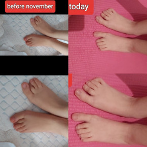 text img