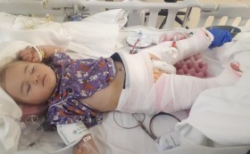 Малката Александра беше оперирана успешно в САЩ